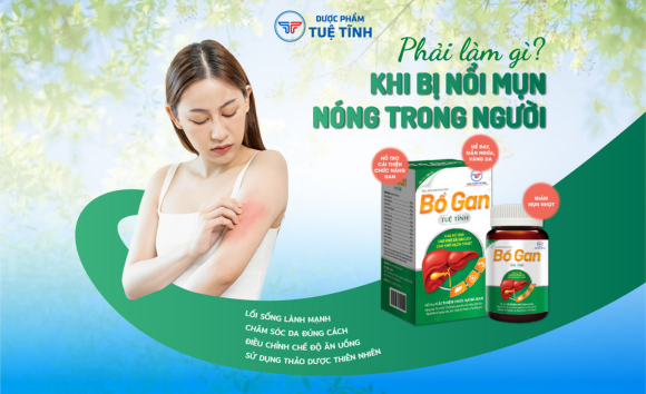 Nóng trong người, nổi mụn phải làm sao?